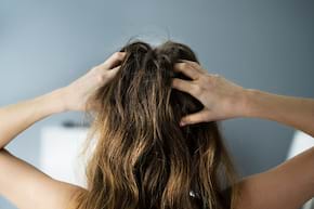 Psoriazisul scalpului versus mătreață: care sunt diferențele și cum ameliorăm m&acirc;ncărimile
