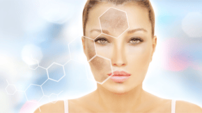 Microdermabraziunea si alte peelinguri cu rezultate vizibile