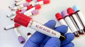 Metode uzuale de investigare a ficatului afectat de hepatita