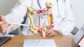 Simptomele cancerului de colon pe care si tinerii trebuie sa le stie