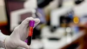 Hemograma completa: ce inseamna rezultatele si care sunt valorile normale la adulti