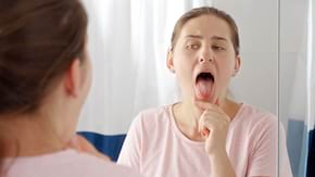 Primele simptome ale cancerului oral (cancerul limbii)