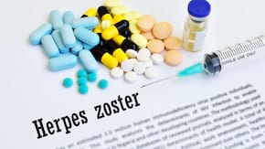 Totul despre Zona Zoster (Herpes Zoster): Cauze &bull; Simptome &bull; Tratament
