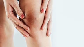 Neurodermatita: cauze, simptome, tratament