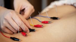 Acupunctura, remediu pentru constipatia severa