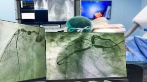 Angiografia coronariană: ce este, cum se efectuează, c&acirc;nd este indicată