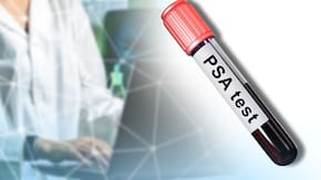 Antigenul prostatic specific (PSA) - instrument util în screening-ul cancerului prostatic?