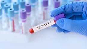 Noul virus HKU5-CoV-2 - o amenințare reală?