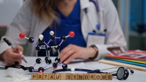 Totul despre sindromul Patau (trisomia 13)