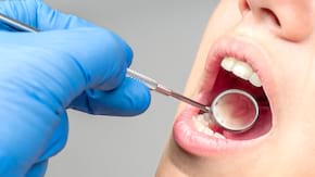 Afecțiunile gingivale: gingivita și parodontita