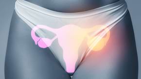 Ovare marite: cauze, simptome si tratament