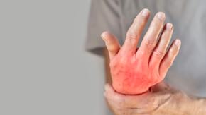 Tratamentul în poliartrita reumatoidă