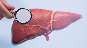 Chisturile hepatice - cum se tratează?