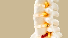 Durere lombară cauzată de spondilită: diagnostic & tratament