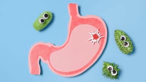 Helicobacter Pylori - Cauze, Simptome & Tratament