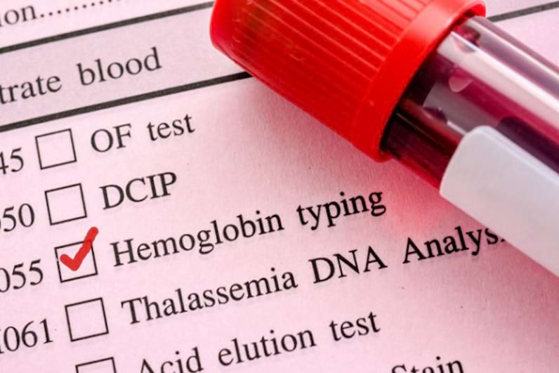 Hemoglobina: Ce este? Tipuri si Forme & Cauze