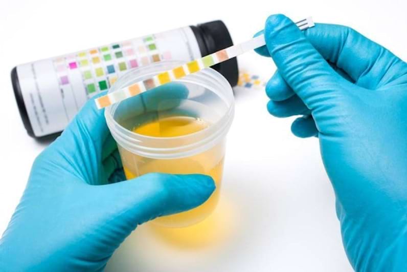 Miros anormal al urinei | ROmedic