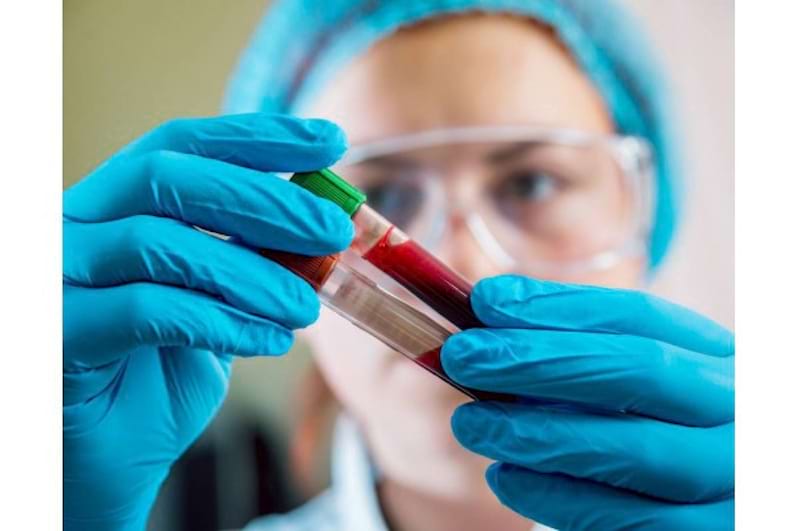 Testele de laborator care depisteaza hepatita C