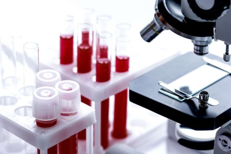 Analiza VSH: Ce este? - Rolul acestui test de sange - Valori Normale VSH