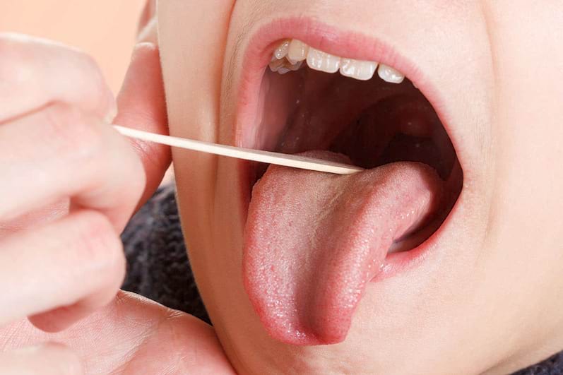 Microbiomul limbii si rolul in sanatate