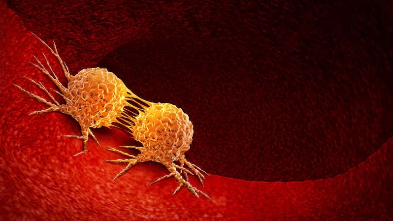 Colesterolul mărit ar putea alimenta celulele canceroase (studiu)