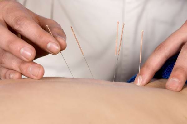 tratamentul prostatitei cronice cu acupunctură)