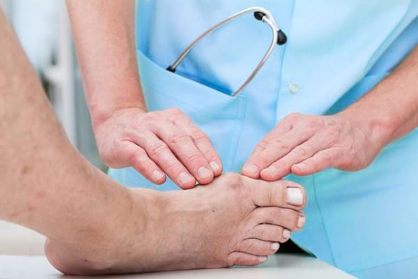 ce este guta si cum se manifesta tratament eficient pentru genunchi