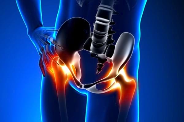 cremă de artropant articulațiile picioarelor doare ce să facă tratament
