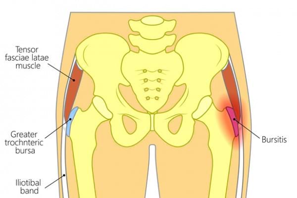 nu durere severă la genunchi artroza articulațiilor intervertebrale ale tratamentului coloanei lombare