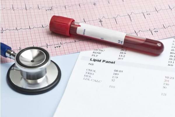 colesterol ridicat i varicoza varking pe legi recenzii