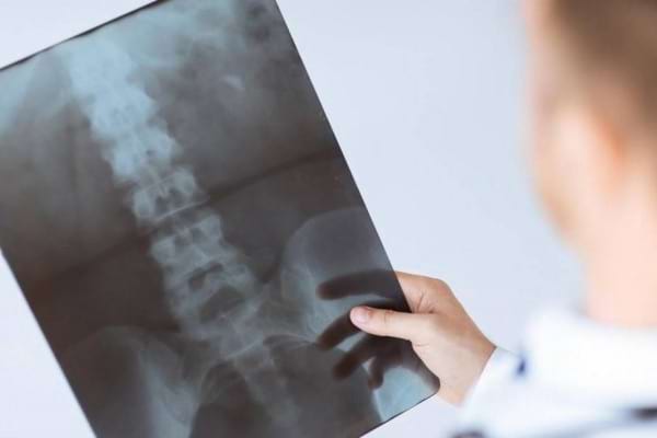 Durerea de spate: când este necesară o consultație la medicul reumatolog? | SANADOR