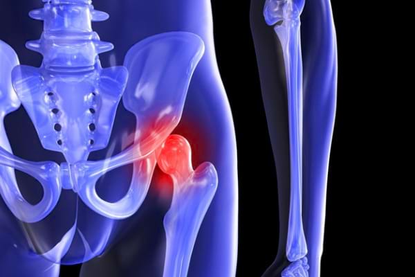 schema de tratament pentru artroza genunchiului 2 grade dureri de genunchi după artroplastie
