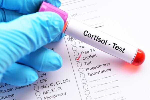 cortizol scazut simptome
