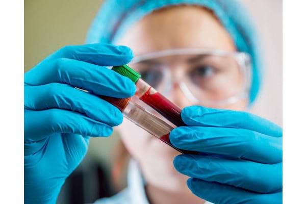 Testele De Laborator Care Depisteaza Hepatita C
