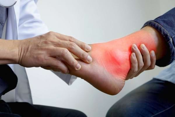 medicamente pentru durerea cu artroza genunchiului