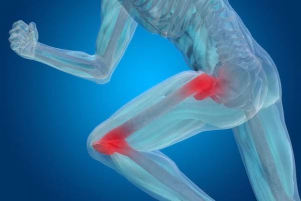 coxartroză durere de genunchi durere în partea dreaptă culcat pe spate