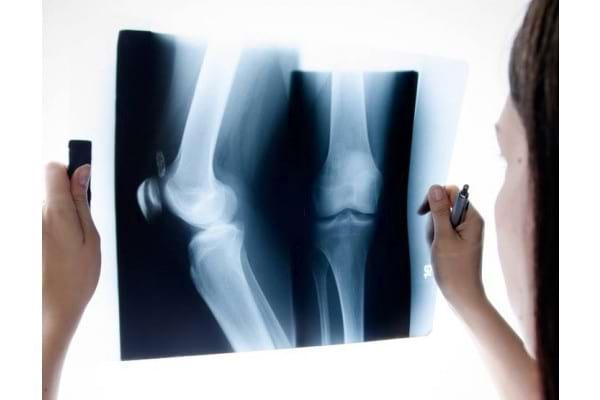 și în Gitt tehnica de tratare a artrozei durerea în articulația genunchiului nu îndoaie tratamentul