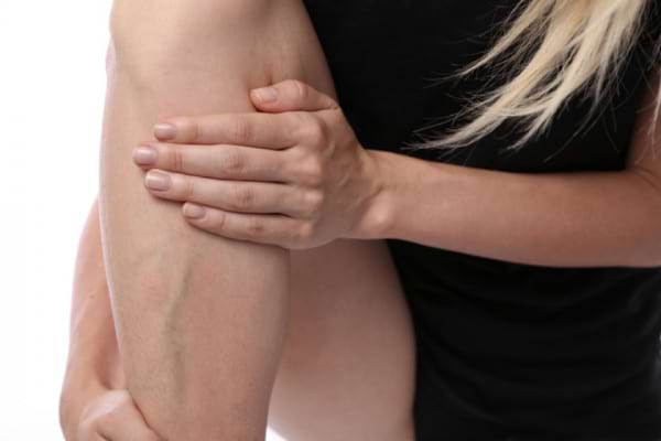 Eczema pe picioare în tratamentul venelor varicoase - julisbijoux.ro