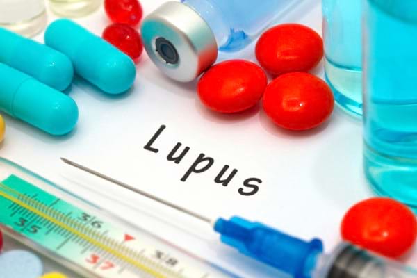 5 Mituri Despre Lupus Demontate