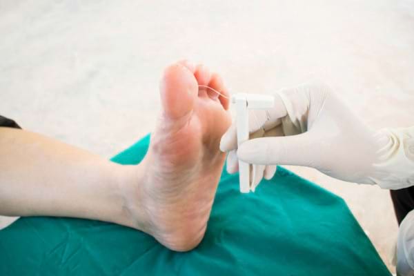 Tot Ce Trebuie Sa Stii Despre Neuropatia Diabetica Cauze Simptome Tratament
