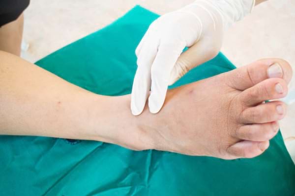 Neuropatia Diabetica Tipuri Si Simptome