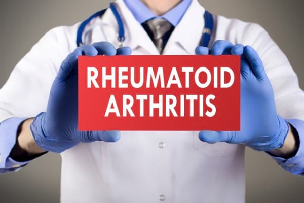 Artrita reumatoida – analize
