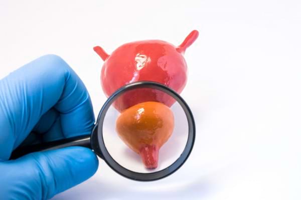 De ce este sparanghel contraindicat pentru prostatita