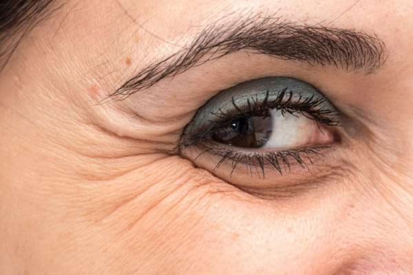 Ridurile din jurul ochilor: 3 greşeli pe care le faci