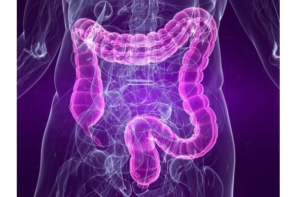 Pierderea în greutate a bolii intestinale iritabile - Sindromul de colon iritabil și cancerul