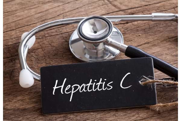 Speranta de viata si complicatiile la pacientii cu hepatita C