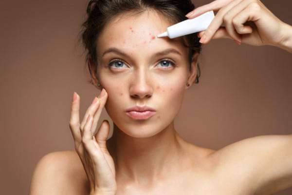 piele predispusă la acnee anti-îmbătrânire