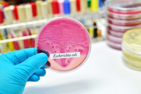 Totul despre E. coli: cum se transmite, ce afecÈiuni provoacÄ Èi cum poate fi prevenitÄ