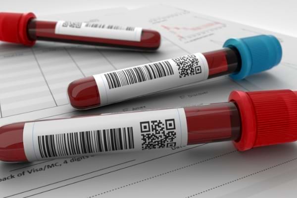 Simptome și diagnostic în lupus