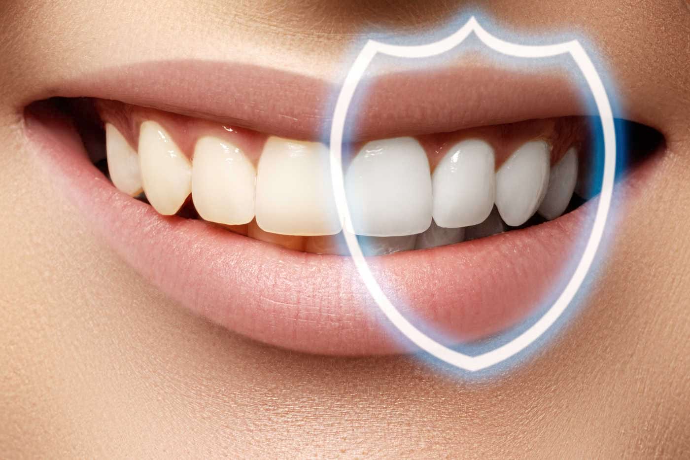 Cele mai frecvente probleme dentare